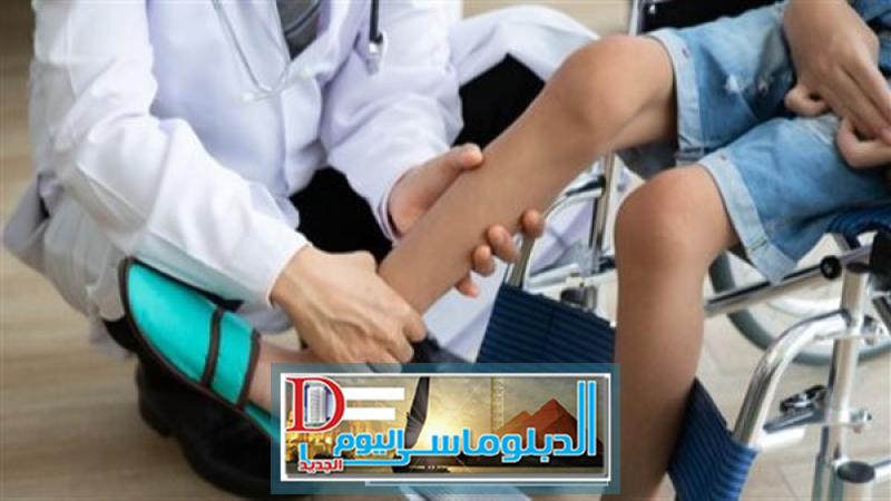 ضمور العضلات