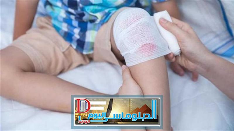 حوادث  تلميذة الكاتيل - تعبيرية