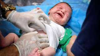 أطفال غزة الرضع يتساقطون من الجوع وقلة الإمكانيات الطبية (فيديو)