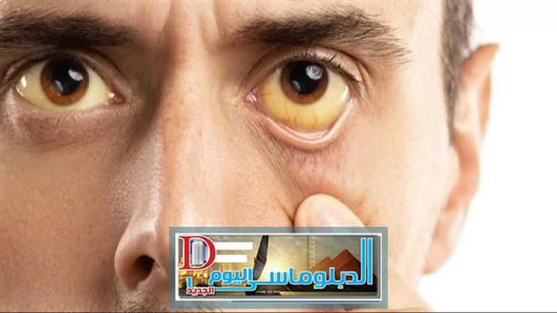 صورةتعبيرية